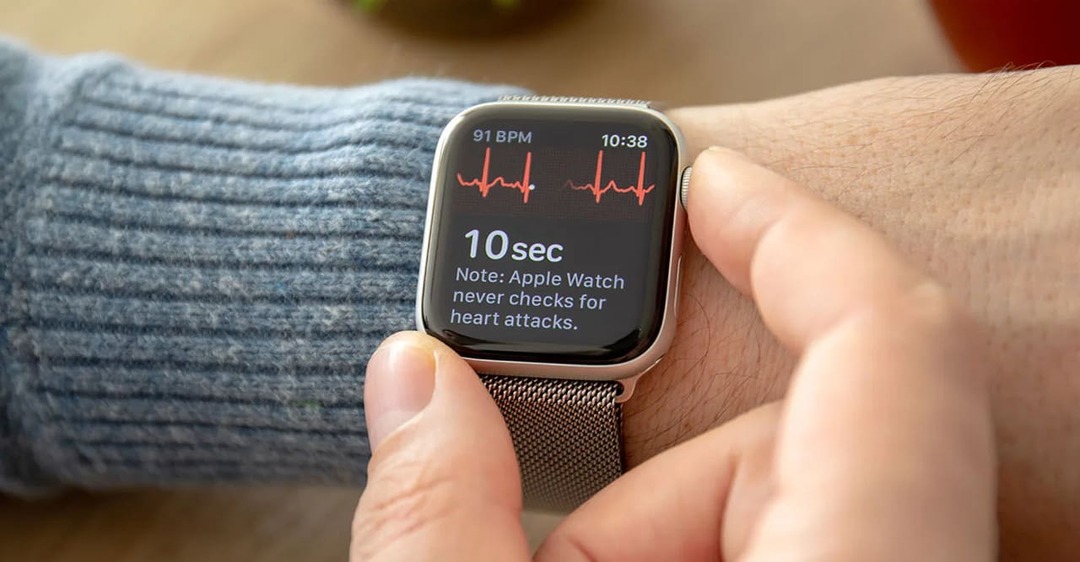 ECG trên Apple Watch là gì