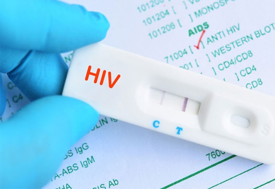 khi nào cần xét nghiệm phát hiện hiv